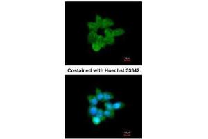ICC/IF Image Immunofluorescence analysis of methanol-fixed A431, using CLCA1, antibody at 1:200 dilution. (CLCA1 抗体)