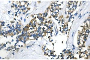 IHC analysis of UBR2 using anti-UBR2 antibody (ABIN7599609).
