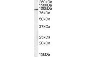 Image no. 3 for anti-Signal Transducer and Activator of Transcription 3 (Acute-Phase Response Factor) (STAT3) (C-Term) antibody (ABIN184593)