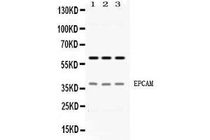Western Blotting (WB) image for anti-Epithelial Cell Adhesion Molecule (EPCAM) (AA 147-189), (Middle Region) antibody (ABIN4886570)