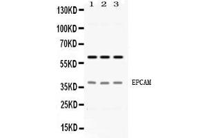 Western blot analysis of EPCAM expression in HELA whole cell lysates ( Lane 1), A549 whole cell lysates ( Lane 2) and PANC-1 whole cell lysates ( Lane 3). (EpCAM 抗体  (Middle Region))