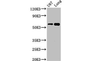 Western Blot Positive WB detected in: U87 whole cell lysate, Mouse lung tissue All lanes: SHC3 antibody at 3 μg/mL Secondary Goat polyclonal to rabbit IgG at 1/50000 dilution Predicted band size: 65, 52 kDa Observed band size: 65 kDa