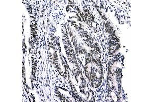 Immunohistochemistry (IHC) image for anti-Chromobox Homolog 3 (CBX3) (AA 2-183) antibody (ABIN5693033)