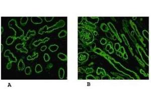Reactivity of laminin α5 chain specific monoclonal antibody 4B12 on human embryonic lung alveolae epithelium (A) and kidney (B) preparation (Laminin 5 抗体)