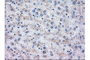 Immunohistochemical staining of paraffin-embedded liver tissue using anti-OXSR1mouse monoclonal antibody. (OXSR1 抗体)