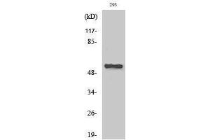 Western Blotting (WB) image for anti-Cholinergic Receptor, Nicotinic, alpha 5 (Neuronal) (CHRNA5) (Internal Region) antibody (ABIN3180473)