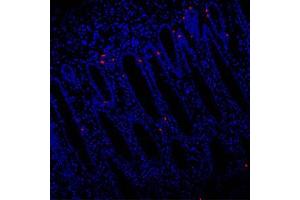 Immunofluorescent analysis of paraffin-embedded human colon using EIF2S2 (ABIN7073880) at dilution of 1: 1000