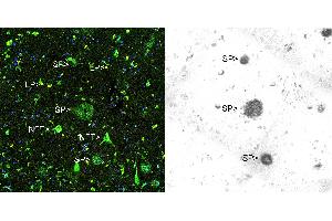 Immunohistochemical analysis of paraffin-embedded Alzheimer's hippocampus using Thioflavin S (left panel) and Beta Amyloid antibody using the HRP-DAB staining technique. (beta Amyloid 抗体)
