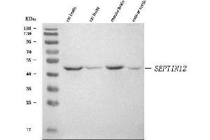 Western blot analysis of SEPTIN12 using anti-SEPTIN12 antibody (ABIN7602363).