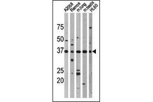 Western blot analysis of anti-Phospho-p53-T18 Pab (cat (ABIN389626 and ABIN2839626)) in, from left to right, , Ramos, mouse lung, mouse testis, and HL60 cell line lysates. (p53 抗体  (pThr18))