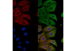 ABIN6257631 and ABIN6274765 staining Hela cells by IF/ICC. (RPL10A 抗体  (C-Term))