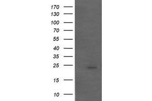 Image no. 1 for anti-Amyloid P Component, Serum (APCS) antibody (ABIN1500899) (APCS 抗体)
