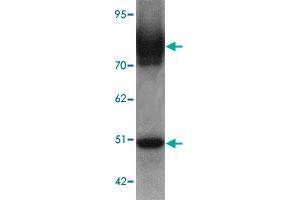 Western blot analysis of SLC39A6 in mouse lung tissue lysate with SLC39A6 polyclonal antibody  at 1 ug/mL. (SLC39A6 抗体  (Internal Region))