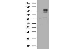 Western Blotting (WB) image for anti-ADAM Metallopeptidase with thrombospondin Type 1 Motif, 8 (ADAMTS8) antibody (ABIN2715722)