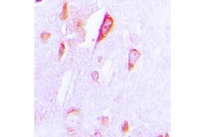 Immunohistochemical analysis of Cytochrome P450 1A1/2 staining in human brain formalin fixed paraffin embedded tissue section. (CYP1A1/2 抗体  (Center))