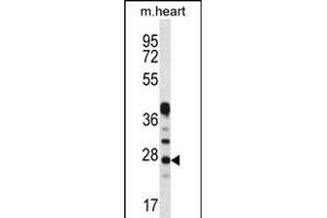 CRYBA1 Antibody (Center) (ABIN656311 and ABIN2845613) western blot analysis in mouse heart tissue lysates (35 μg/lane). (CRYBA1 抗体  (AA 104-133))