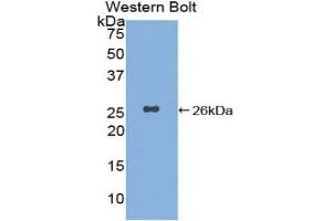 Western blot analysis of the recombinant protein. (XPC 抗体  (AA 734-933))