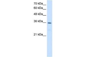 Western Blotting (WB) image for anti-Methylenetetrahydrofolate Dehydrogenase (NADP+ Dependent) 2, Methenyltetrahydrofolate Cyclohydrolase (MTHFD2) antibody (ABIN2462924) (MTHFD2 抗体)