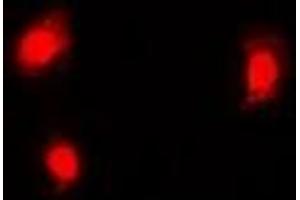 Immunofluorescent analysis of EMSY staining in Hela cells. (EMSY 抗体)