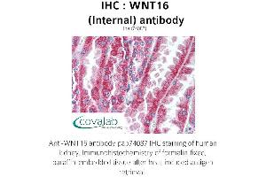 Image no. 1 for anti-Wingless-Type MMTV Integration Site Family, Member 16 (WNT16) (Internal Region) antibody (ABIN1740822)