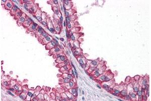 Human Prostate: Formalin-Fixed, Paraffin-Embedded (FFPE) (PTER 抗体  (C-Term))