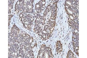 IHC analysis of Cyclophilin E/PPIE using anti-Cyclophilin E/PPIE antibody (ABIN7599242). (PPIE 抗体  (AA 1-301))