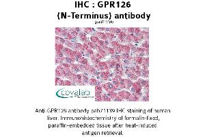 Image no. 1 for anti-G Protein-Coupled Receptor 126 (GPR126) (N-Term) antibody (ABIN1734925) (G Protein-Coupled Receptor 126 抗体  (N-Term))