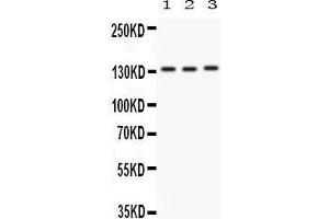 Anti-Integrin alpha 1 antibody, Western blotting All lanes: Anti ITGA1 () at 0. (Integrin alpha 1 抗体  (C-Term))