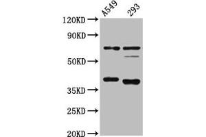 Western Blot Positive WB detected in: A549 whole cell lysate, 293 whole cell lysate All lanes: CTSS antibody at 1:4000 Secondary Goat polyclonal to rabbit IgG at 1/50000 dilution Predicted band size: 38, 32 kDa Observed band size: 38 kDa (Cathepsin S 抗体  (AA 115-331))