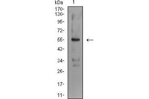 Western Blotting (WB) image for anti-ASF1 Anti-Silencing Function 1 Homolog B (ASF1B) (AA 1-202) antibody (ABIN5611236)