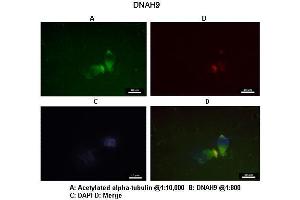 Immunohistochemistry (IHC) image for anti-Dynein, Axonemal, Heavy Chain 9 (DNAH9) (C-Term) antibody (ABIN2790246) (DNAH9 抗体  (C-Term))