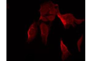 Immunofluorescence (fixed cells) (IF/ICC) image for anti-Ribosomal Protein S6 Kinase, 70kDa, Polypeptide 1 (RPS6KB1) (pThr389), (pThr412) antibody (ABIN6256559)