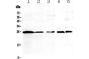 Western blot analysis of IL36 alpha using anti-IL36 alpha antibody . (IL36A/IL1F6 抗体  (AA 6-158))