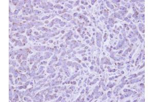 Immunohistochemistry (IHC) image for anti-RAB6A, Member RAS Oncogene Family (RAB6A) antibody (ABIN2856770)