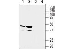 Western blot analysis of rat kidney (lanes 1 and 3) and rat liver (lanes 2 and 4) lysates: - 1, 2. (GPR81 抗体  (C-Term, Intracellular))
