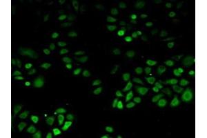 Detection of PDHX in Human Hela Cells using Polyclonal Antibody to Pyruvate Dehydrogenase Complex Component X (PDHX) (PDHX 抗体  (AA 220-468))