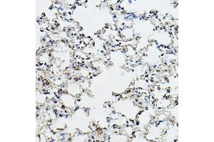 Immunohistochemistry (IHC) image for anti-Cyclin E1 (CCNE1) (AA 300-410) antibody (ABIN7266565)