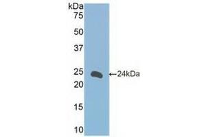 Western Blotting (WB) image for anti-Fc Fragment of IgE, Low Affinity II, Receptor For (CD23) (FCER2) (AA 150-330) antibody (ABIN7433822)