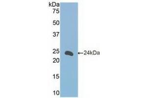 Detection of Recombinant FceRII, Mouse using Polyclonal Antibody to Cluster Of Differentiation 23 (CD23)