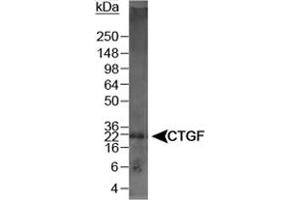 Western blot analysis of CTGF in mouse kidney lysate using CTGF polyclonal antibody . (CTGF 抗体  (AA 299-349))