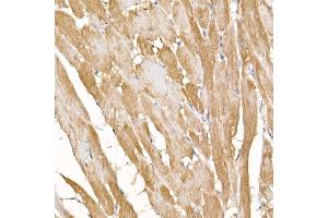 Immunohistochemistry (IHC) image for anti-Cytochrome C Oxidase Subunit VIIa Polypeptide 1 (Muscle) (COX7A1) (AA 1-79) antibody (ABIN7266644)