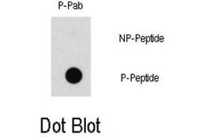 Dot blot analysis of RAF1 (phospho S43) polyclonal antibody  on nitrocellulose membrane. (RAF1 抗体  (pSer43))