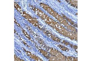 IHC analysis of Mucin-5AC using anti-Mucin-5AC antibody (ABIN3043460).