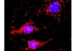 Proximity Ligation Analysis of protein-protein interactions between DVL1 and CTNNB1. (DVL1 抗体  (AA 1-444))