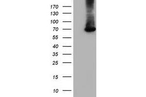 HEK293T cells were transfected with the pCMV6-ENTRY control (Left lane) or pCMV6-ENTRY EPM2AIP1 (Right lane) cDNA for 48 hrs and lysed. (EPM2AIP1 抗体)
