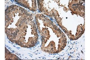 Immunohistochemical staining of paraffin-embedded Human Kidney tissue using anti-SNX9 mouse monoclonal antibody.