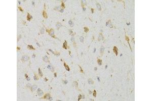 Immunohistochemistry of paraffin-embedded Rat brain using KISS1R Polyclonal Antibody at dilution of 1:100 (40x lens). (KISS1R 抗体)