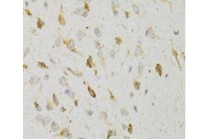 Immunohistochemistry of paraffin-embedded Rat brain using KISS1R Polyclonal Antibody at dilution of 1:100 (40x lens). (KISS1R 抗体)