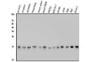 Western blot analysis of FIS1 using anti-FIS1 antibody (ABIN7598965).