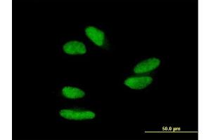 Immunofluorescence of purified MaxPab antibody to ZNF398 on HepG2 cell. (ZNF398 抗体  (AA 1-642))